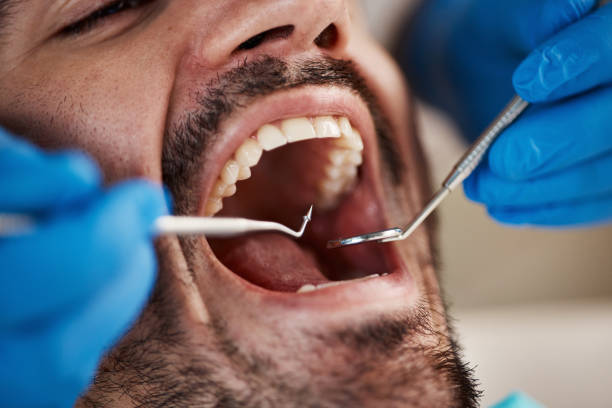Best Emergency Dentist for Special Needs Patients in Crainvle, IL